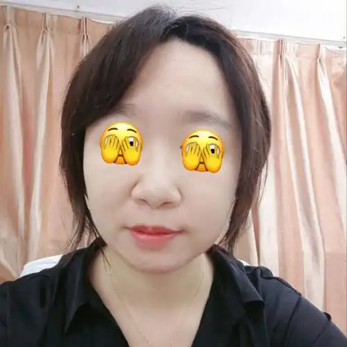 左边法令纹深,微笑时候可以有意识控制自己的脸,尽量看起来不歪