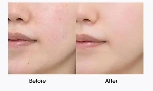 会保养的女孩,就算长相一般,护肤对了怎么都很美