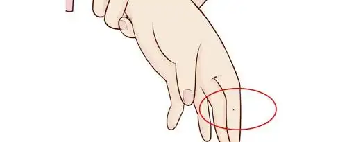 左手食指有痣的女人 左手食指有痣的女人命运-善吉算命网