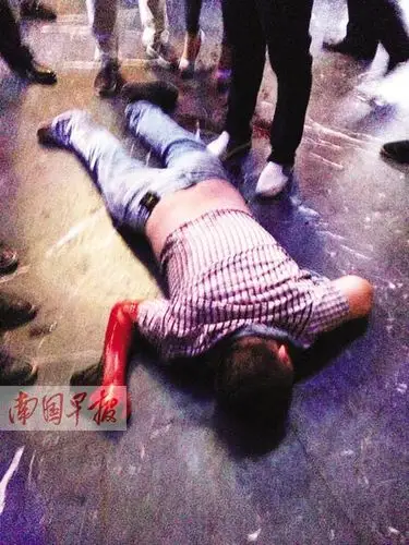 北流男子与老乡在酒吧喝酒玩闹 眼球被打裂开两半