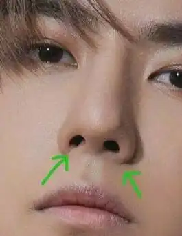 王一博被质疑"整容"「王一博疑似被证实整容」