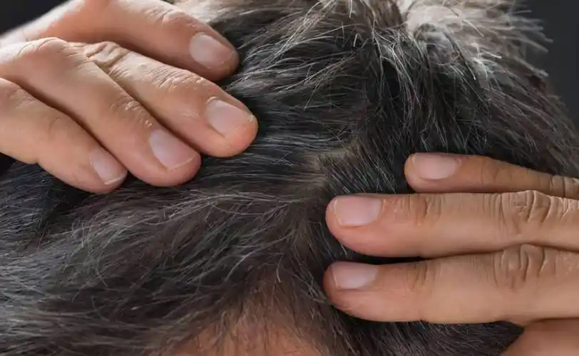 有白头发最好不要染,日常多吃这2种食物,或可以让白头发少一些