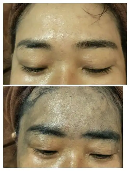 流行美升级芙迪伊娜(智能皮肤管理中心)开业活动啦!(副本)