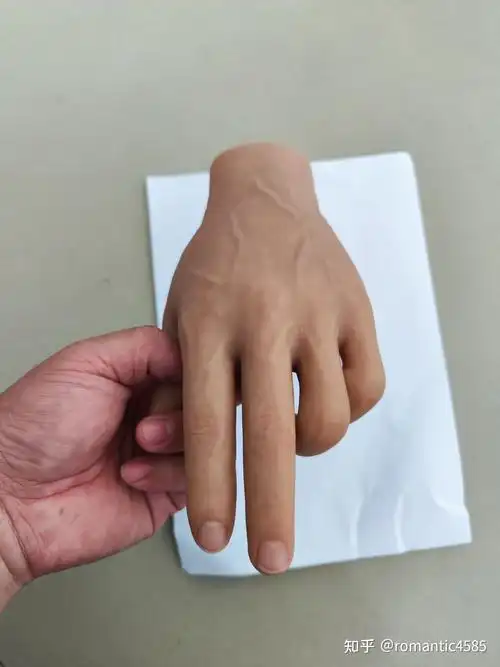 假指,拉链半掌美容手,前臂美容手假肢的介绍         (2020年7月1日)