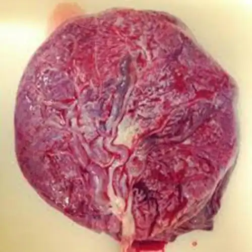 人胎盘详细的特征图片