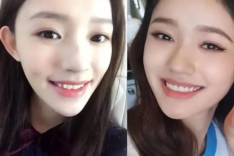 整齐洁白的烤瓷假牙