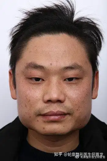 方脸,国字脸长在男生脸上会给人轮廓感,硬汉十足,当然也要适度,过于