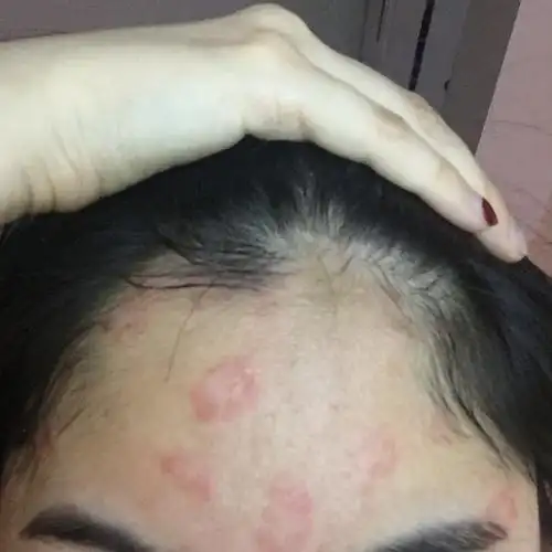 扫一扫图片识别皮肤病app