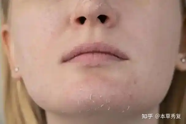 一旦皮肤缺水你就会比同龄人老十岁