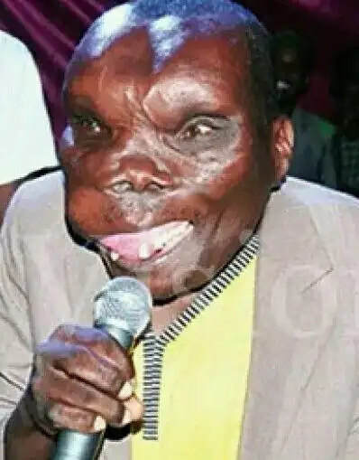 然而,一位被称为世界上最丑的人,丑的瘆得慌,却拥有一些人拥有不到的