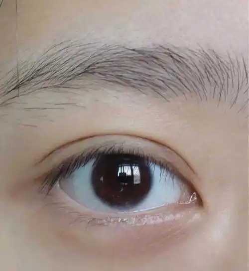 双眼皮属于自然的吧