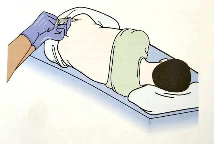 骨髓穿刺活检伤身体吗?