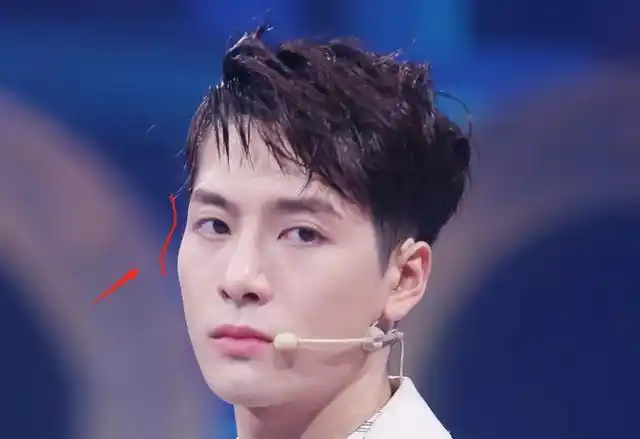 王嘉尔变成牙套脸颧骨外扩太阳穴也凹陷太多明星因此颜值骤降