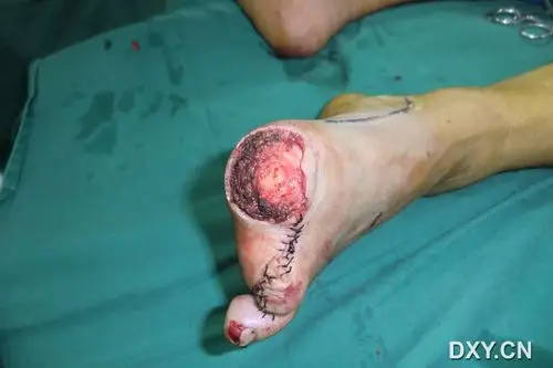 切换新版 >> 不再显示 × 查看 可能涉及到敏感图片,点击后可查看