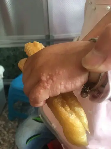 好像疙瘩,望懂得朋友解答一下谢谢