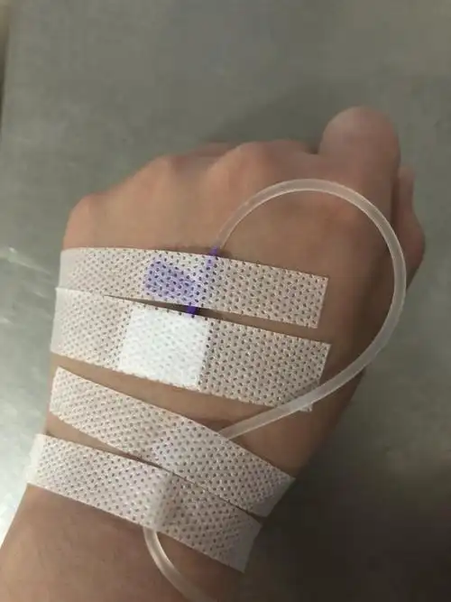 拜托友友们给我一些打吊瓶的照片