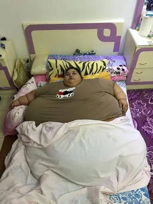 如今的体重已经达到了990斤,被称为"世界上最胖的女人",重达千斤的