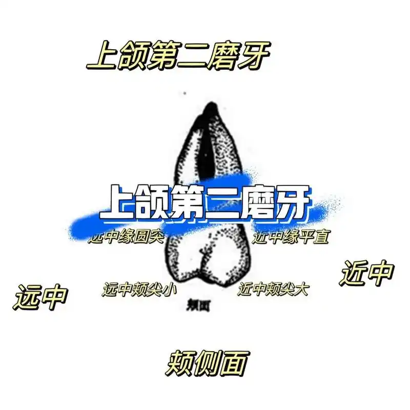 口解五 上颌第二磨牙 上颌第二磨牙颊面是略圆钝的梯形,颊侧近中轴面