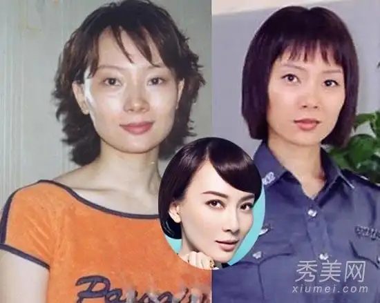 陈数方脸变锥子脸