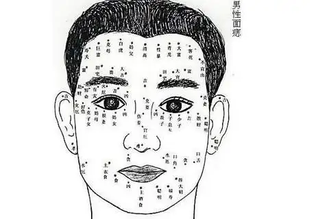 如果女人在脖子左边的位置长痣,代表了这样痣相特点的女人会有着比较