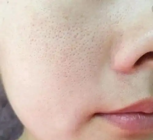 毛孔悄悄变大,特显老,洗脸做到"四不"和"四要"