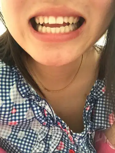 我想问下我的牙齿有什么问题吗 从小就很乖的刷牙 可是牙齿就是黄