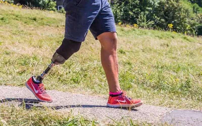 价廉物美的假肢品牌欢迎致电