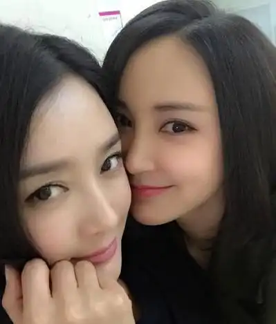 42岁张歆艺对比43岁秦岚,"打针脸"和自然老去差别一目然