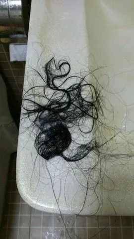 头发掉成这样是不是要秃了,怎麼办