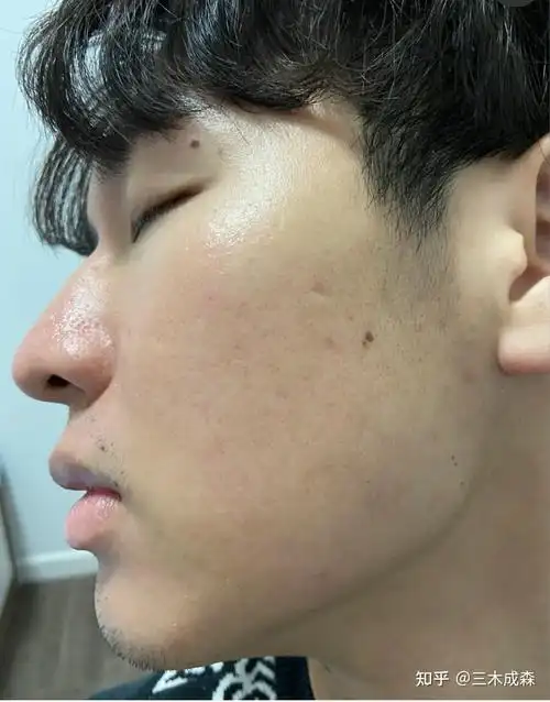 用完一次,我那憔悴不堪,暗沉粗糙,肤色不均,毛孔粗大的整张脸,第二天