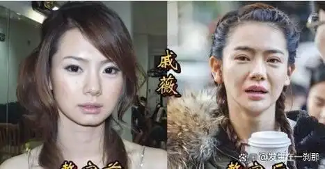 18位女星整容前后对比尚雯婕是最成功的一位