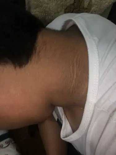 30 皮肤变黑像很久没洗过澡的灰一样,但是怎么洗