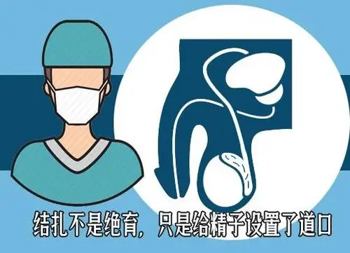 比起妻子为你上环男性结扎这6件事你更该了解