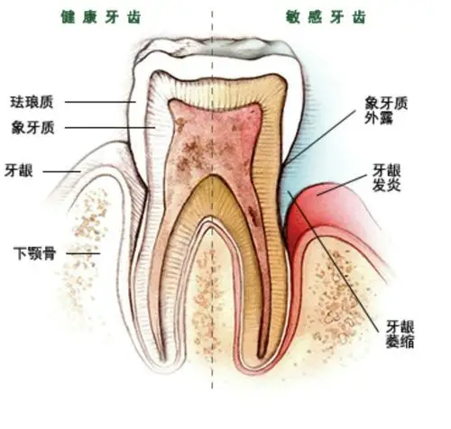 小练子和你分享如何保护好自己的牙齿