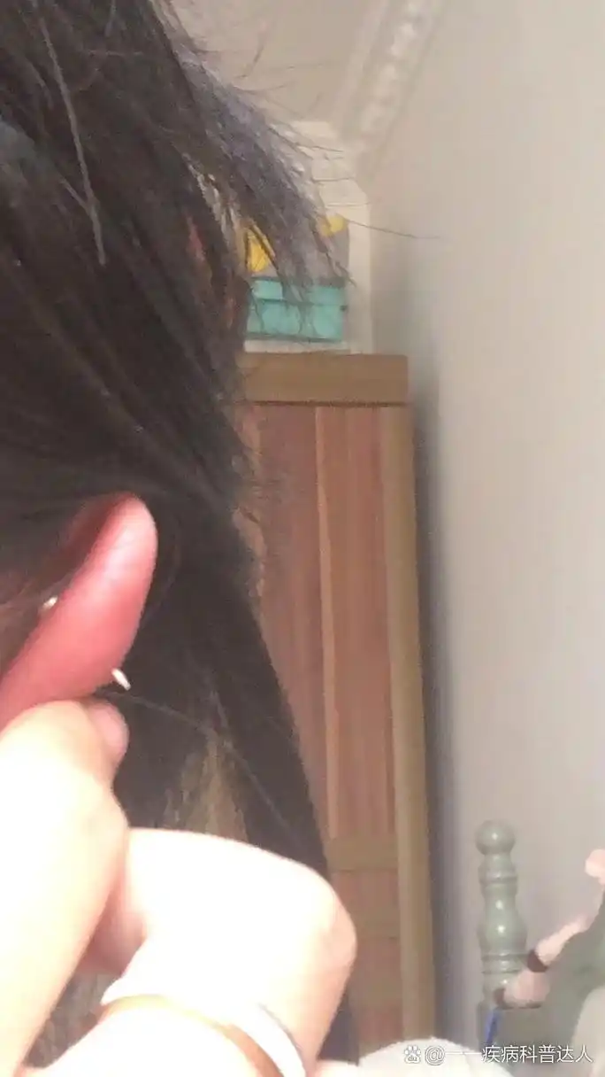 怎么办啊🥹🥹🥹🥹有懂的家人😭😭😭😭😭耳骨肿了