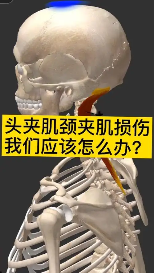头夹肌颈夹肌损伤疼痛,颈椎活动受限,怎么办
