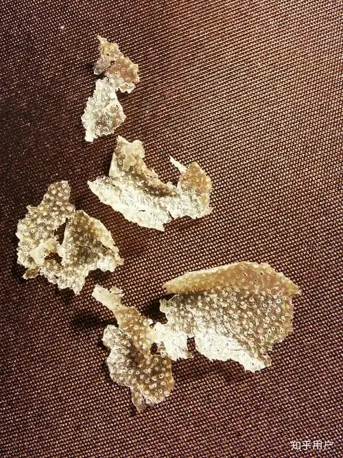 见过的最大头皮屑多大