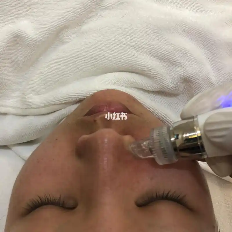 汇宝国际公寓攻略_韩国_清洁毛孔_清洁_肌肤补水_去黑头_护肤