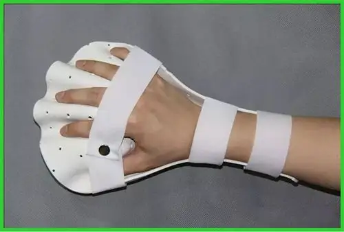 矫形器在手部烧伤中应用|佳满矫形器|常见问答|湖南佳满假肢 您的假肢