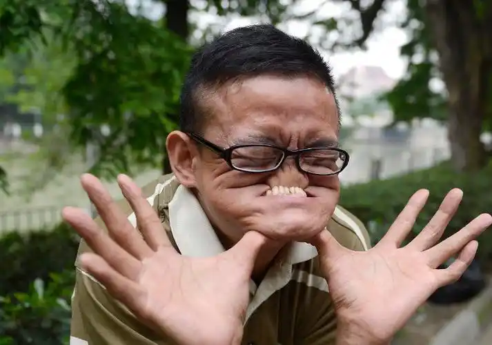 因为丑得世界纪录的第一人到底是有多丑我如花表示不服