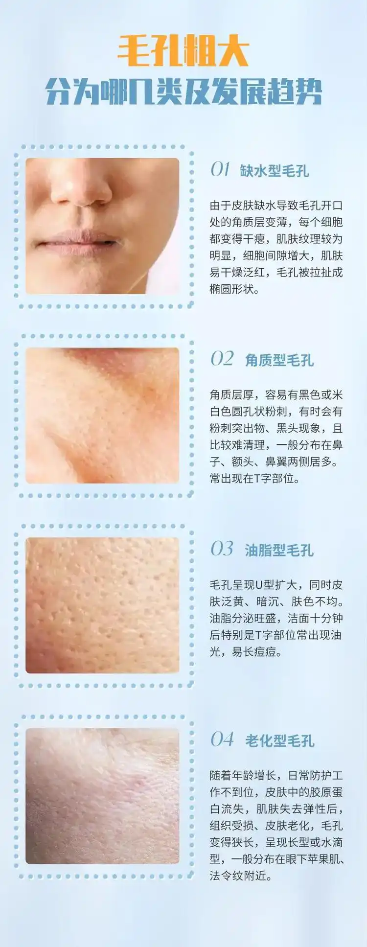 毛孔粗大的原因#毛孔粗大 #收缩毛孔 #问题性皮肤管理 - 抖音