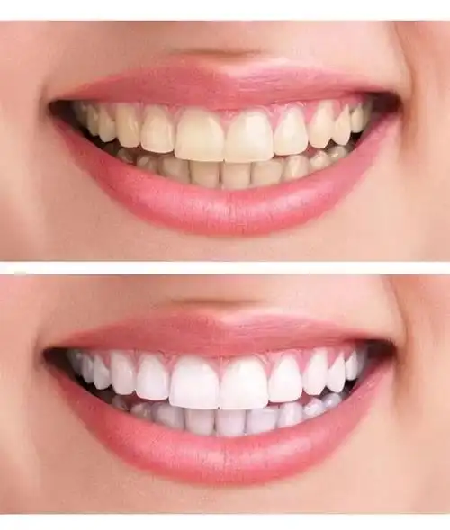 久木堂云南本草亮白洗牙粉去黄洗白美白牙齿神器牙白牙黄口气臭洁牙