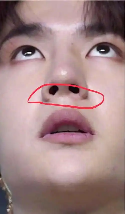 自从走红以后负面新闻接二连三的被发出王一博牙齿王一博的牙齿王一博