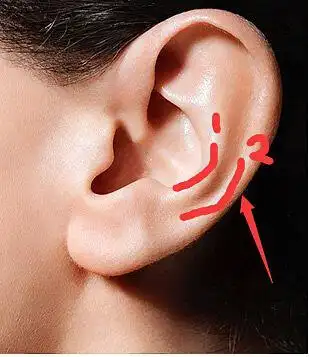 为什么我的耳朵没有这道弯?