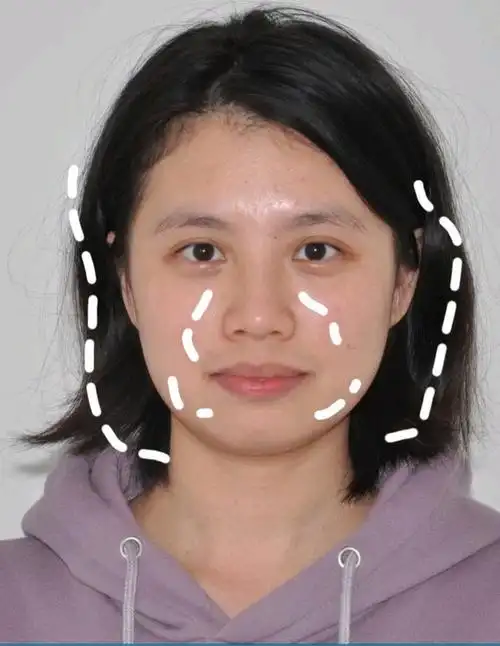 姐妹你的五官属于比较低平一点,整体立体感不强,无论是颧骨外扩,蒜头