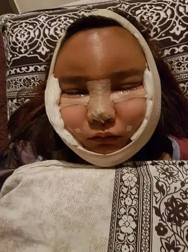 泰国网红4姐妹整容后绑绷带上街吓坏网友组图913