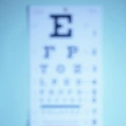 遭到他人的嘲笑,这时患者为了自身形象,又可以快速解决眼睛的视力问题