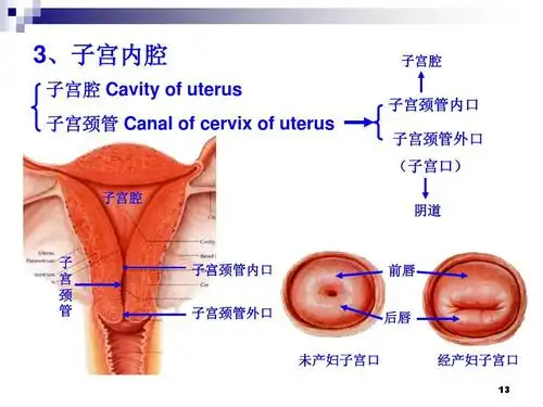 3,子宫内腔 子宫腔 cavity of uterus 子宫颈管 canal of cervix of