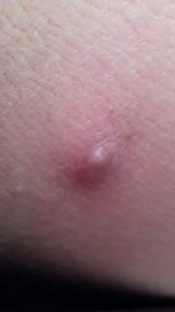 最近有熬夜,是不是有关?