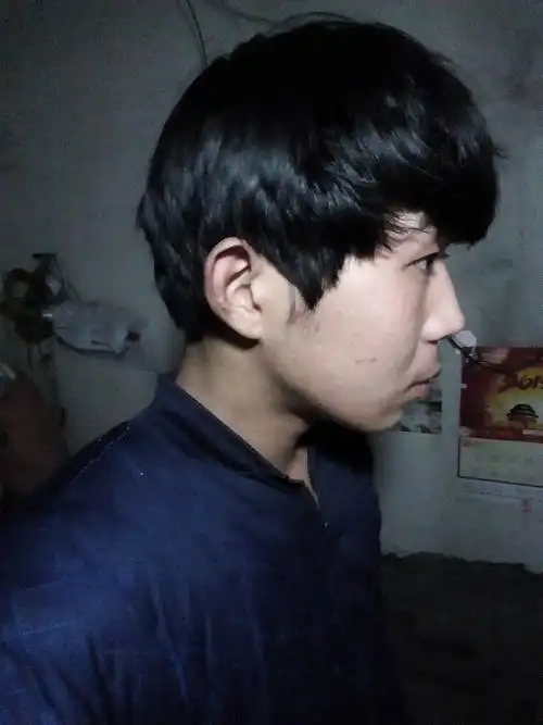 我下巴难看怎么回事?